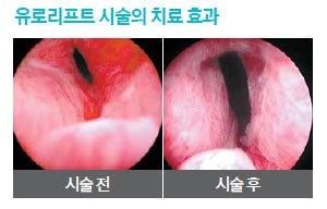 중앙일보