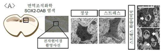 중앙일보