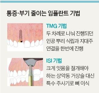 중앙일보