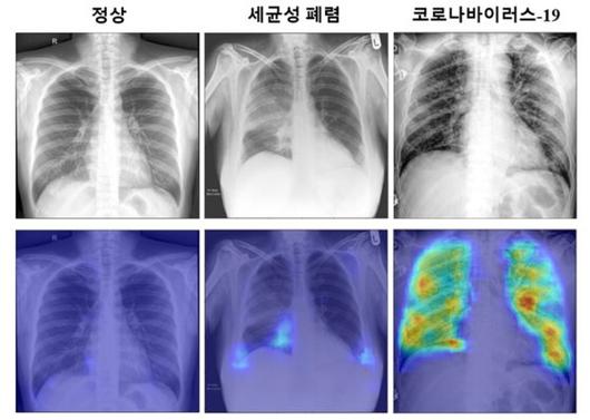 중앙일보