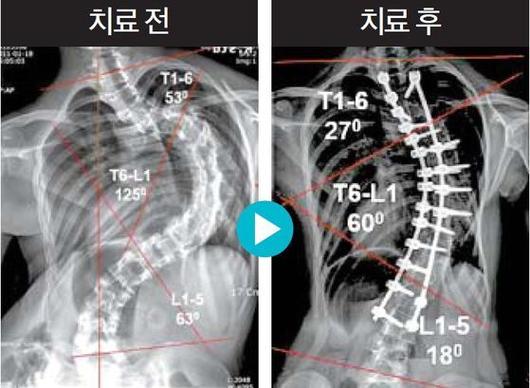 중앙일보