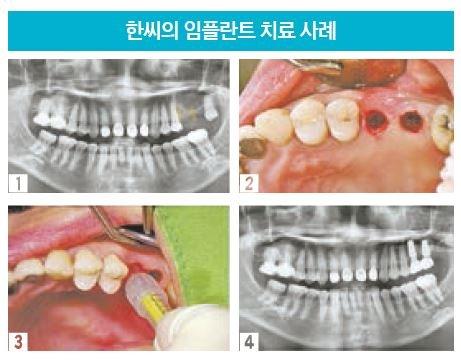 중앙일보