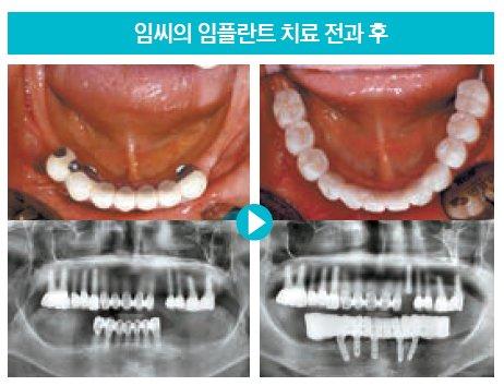 중앙일보