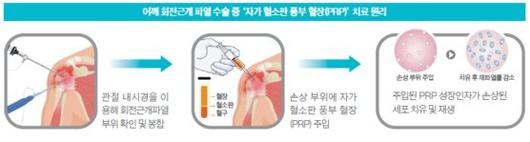 중앙일보