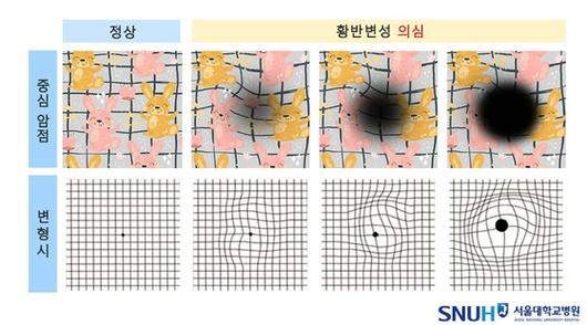 중앙일보