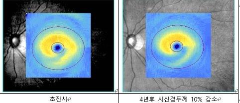 중앙일보