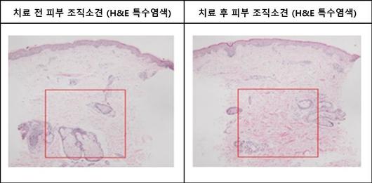 헤럴드경제