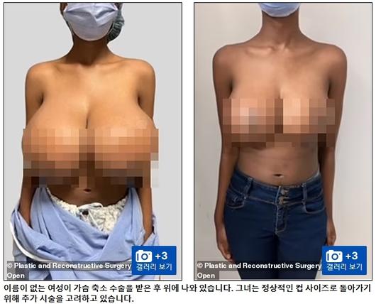 헤럴드경제