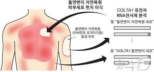 뉴스1