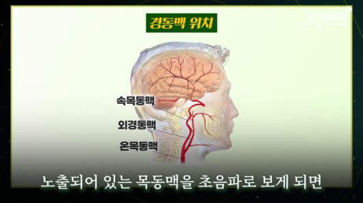 노컷뉴스