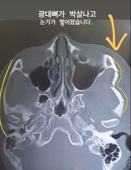 세계일보