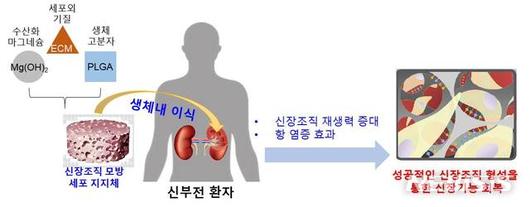 뉴시스