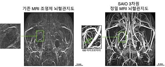 뉴시스