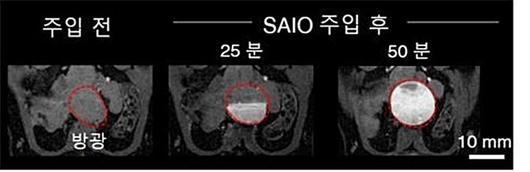 뉴시스