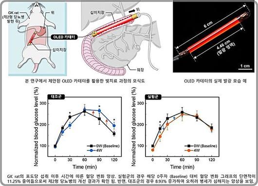 뉴시스