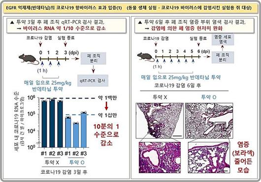 뉴시스