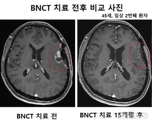 뉴시스