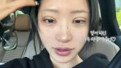 <b>최준희, 쌍꺼풀 재성형…수술 직후 '붓기' 선명한 채로 카메라 켰다</b>