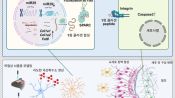 <b>뇌졸중 신경손상 원리 밝혔다…동물실험서 치료 가능성 입증</b>