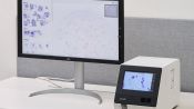 <b>노을, 보스니아에 AI 자궁경부암 진단기기 공급…유럽 시장 확대</b>