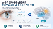 <b>“눈 움직임 일정하지 않다면” 치매 전단계 가능성 높다</b>