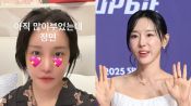 <b>랄랄→이지혜, 성형도 콘텐츠 시대…퉁퉁 부운 얼굴도 '화제성 甲'</b>