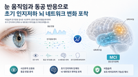 <b>“눈 움직임 일정하지 않다면” 치매 전단계 가능성 높다</b>