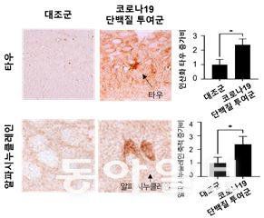 코로나19 바이러스 투여군에서 독성 단백질인 ‘타우’와 ‘알파 시누클레인’이 증가한 사실이 확인됐다. 질병관리청  제공.