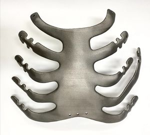 SLM 고속 공정기술로 제작한 맞춤형 인공 흉부 뼈