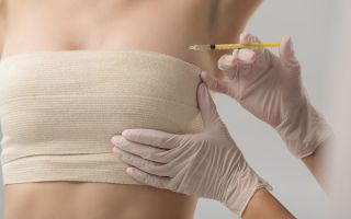 "시신 지방으로 가슴 확대? 난 안 한다"…美 의사 경고에 신기술 논란