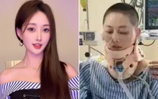 한쪽 다리 잃었지만…35층서 추락, 기적적 생존 20대 여성 근황