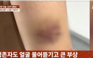 '경산 친구 살해' 현장에 또 다른 피해자 "말리던 친구가 되레 표적"