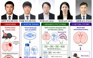 전남대 줄기세포분비체연구단·GIST 이코노어연구단, 뇌졸중 치료 가능성 제시
