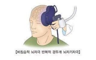 '강박장애 원인 추정 뇌회로 규명…맞춤형 뇌자극 치료 기대"