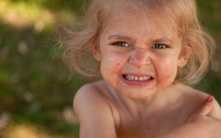 "멍 잘 드는 아이, 꼭 병원에 데려가라"...문희준도 경고한 '치명적 질환'