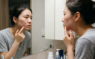 여드름·탈모 잡으려면 얼굴 아닌 '장' 봐야… 장내 미생물의 과학
