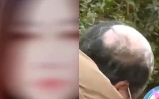 “탈모 생기니까 남편이 이혼하자네요” 30대女 ‘충격 사연’…결말은