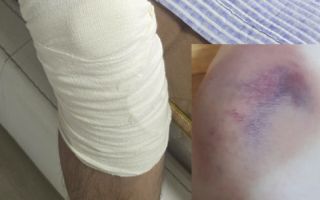 키 190cm·120kg 고교생, 동급생에 '로킥'…전치 6주에도 "장난"