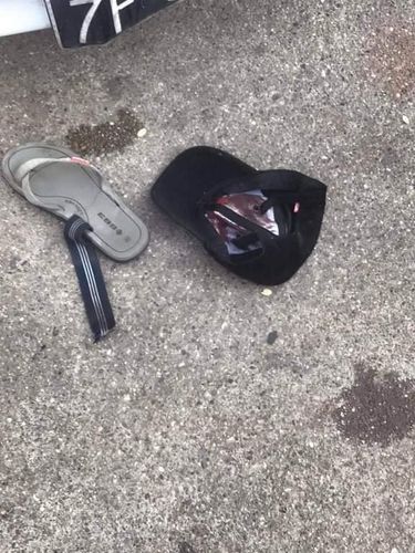 시위대가 도망가다가 흘린 것으로 보이는 소지품들. [SNS 캡처. 재판매 및 DB 금지]