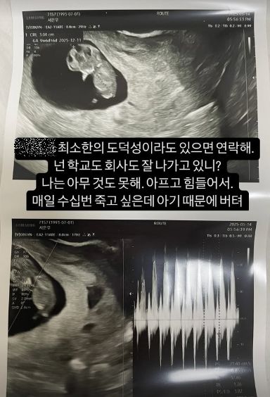 서은우 서민재.사진| 본인 SNS