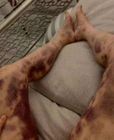 사진=아옳이 SNS