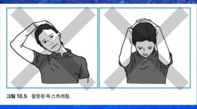 유튜브 ‘정선근TV’에서 소개한 목 디스크 환자가 하면 안 되는 목 스트레칭.