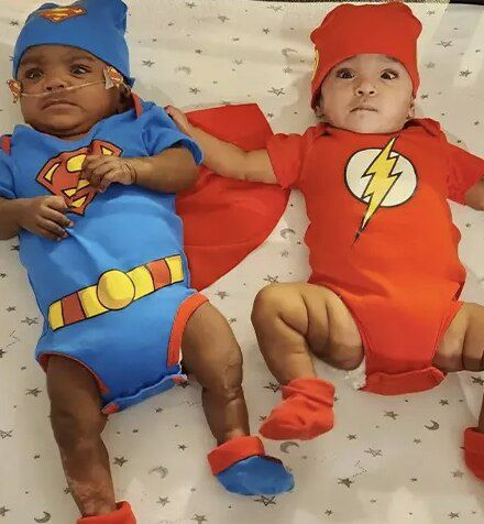 아드리알(왼쪽)과 아디아./기네스북