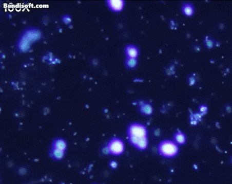 생닭을 씻은 물을 현미경으로 확대한 모습./유튜브