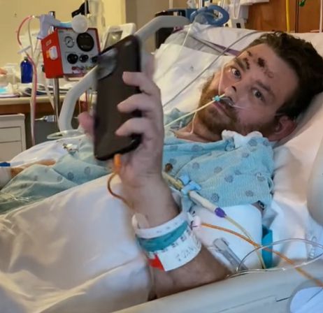 30대 후반 미국 남성 스티븐 스피날레는 사타구니에 생긴 인그로운 헤어를 무리하게 뽑다 패혈성 쇼크로 혼수상태에 빠졌으나, 여러 차례의 수술 후 기적적으로 의식을 되찾았다. [사진=틱톡 캡쳐]