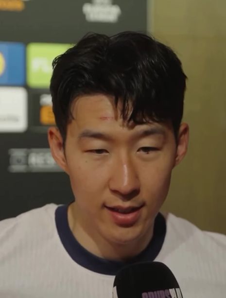 구단과 인터뷰하는 손흥민의 이마에 상처가 남아있다