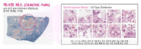 엑사원 패스는 전체 슬라이드 이미지(WSI)에서 암과 관련된 유전자 변이를 예측할 수 있다. (사진=LG AI연구원)