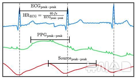 [서울=뉴시스] 심전도(파란색), 광용적맥파 원 신호(초록색), 인공지능으로 분리된 근원 신호(빨간색) 비교. 분리된 근원 신호에서는 심전도 기준 심장 박동 시점과 일치하는 피크가 뚜렷하게 나타난다. (사진= 서울대병원 제공)