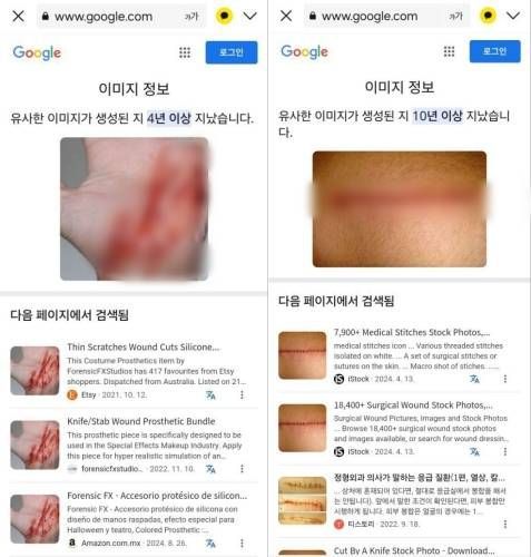 유튜버 이진호가 공개한 김새론 녹취록 제보자의 피습 조작 사진.