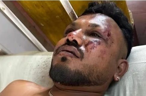 인도 서부 아마다바드 공항 인근에서 발생한 에어인디아 여객기 추락 사고의 생존자가 당시 상황을 이야기했다. 사진은 생존자인 비슈와시 쿠마르 라메시. [사진=힌두스탄타임스]